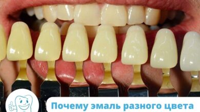 Photo of Все о восстановлении эмали зубов