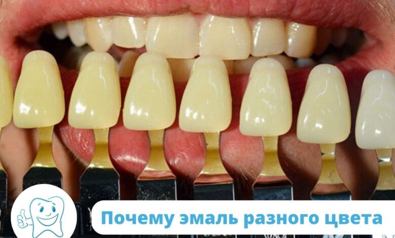 Все о восстановлении эмали зубов