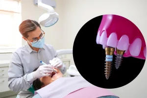 A modern dental clinic interior with a dentist examining a patient's teeth using advanced dental equipment, close-up of dental implants being placed into a jawbone model, soft natural lighting, clean and professional atmosphere