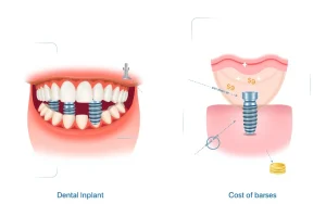 A balanced visual comparison showing dental implants: on one side, a healthy, natural-looking smile with implants seamlessly integrated into gums and jawbone, highlighting benefits like durability and aesthetics; on the other side, subtle indicators of potential drawbacks such as minor gum inflammation, surgical site, or cost symbols (e.g., a small coin stack), all rendered in a clean, professional medical illustration style with soft lighting and neutral background