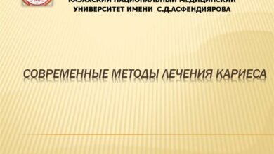 Photo of Лечение кариеса: лучшие методы и рекомендации
